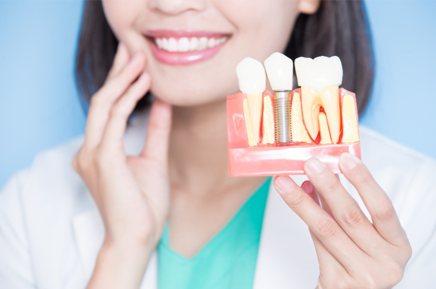Dental implant consultation
